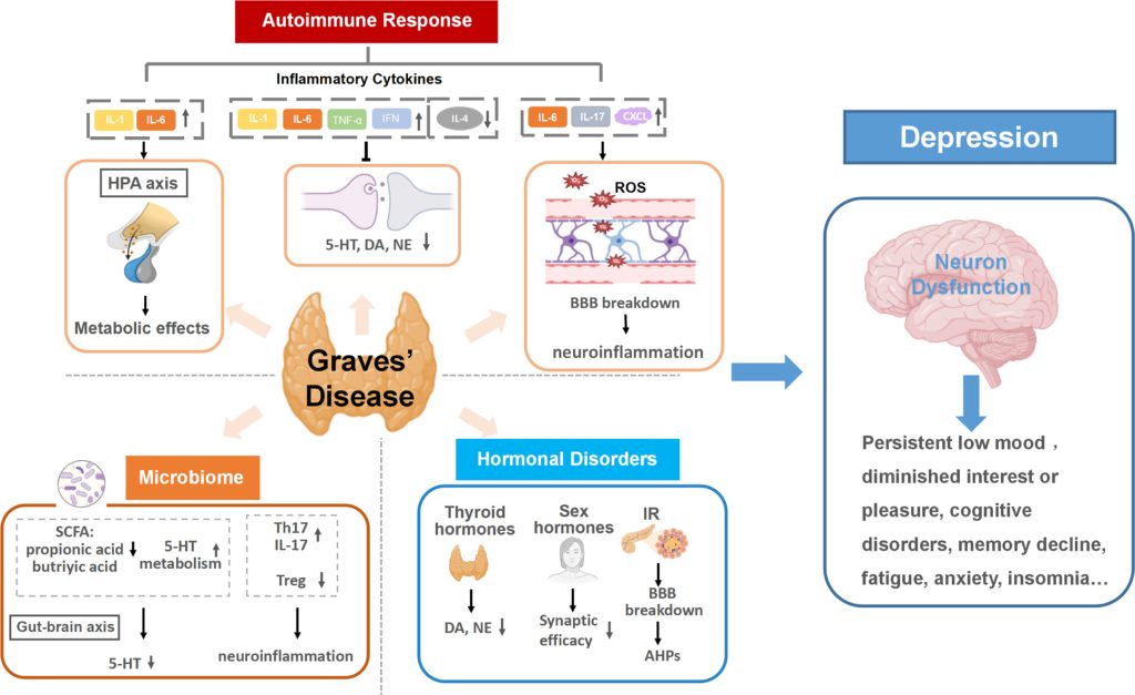 graves disease