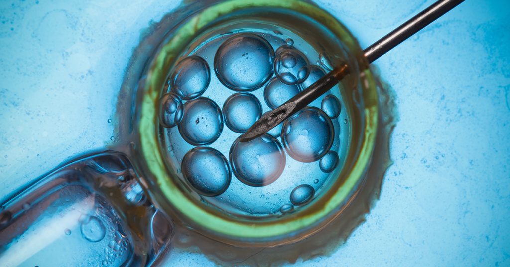 ivf
